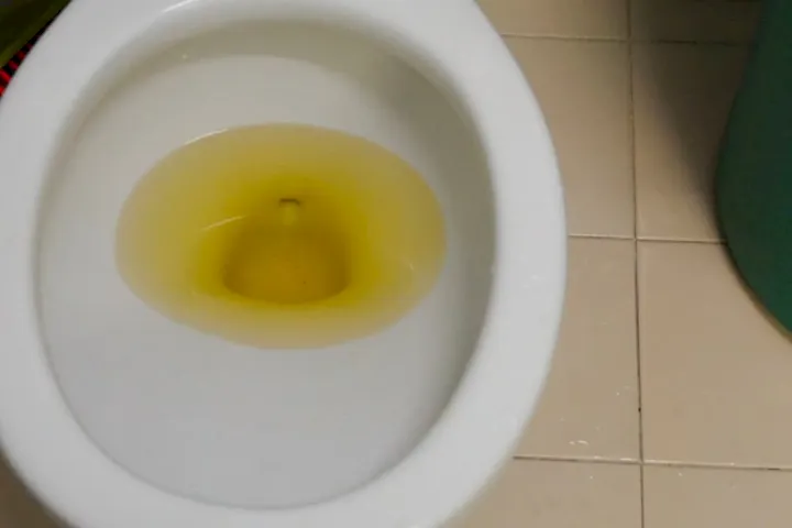 8 Reasons Why Your Toilet Water is Yellow Causes Solutions